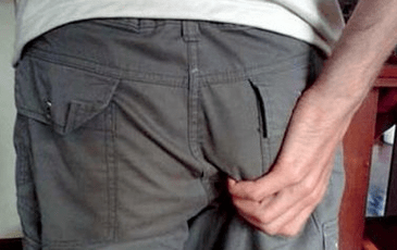 Démangeaisons dans l'anus comme symptôme de la présence de parasites.