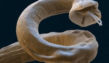 Le parasite Ascaris dans le corps humain.