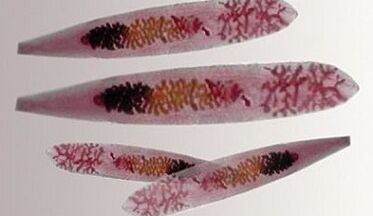 Parasites Opisthorchis dans le corps humain.
