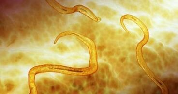 parasites des oxyures dans le corps humain