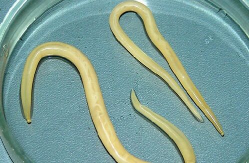 vers intestinaux du corps d'un enfant
