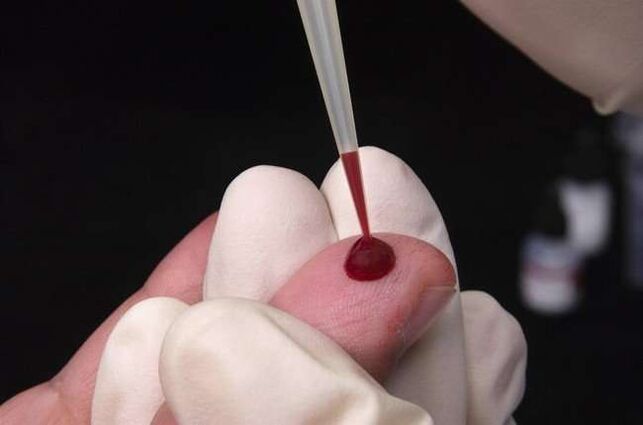collecte de sang pour le dépistage des parasites