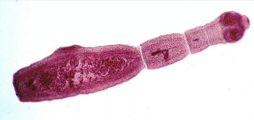 L'échinocoque est l'un des parasites les plus dangereux pour l'homme. 